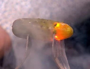 Τί συμβαίνει στο σώμα όταν το χτυπάει κεραυνός (βίντεο)